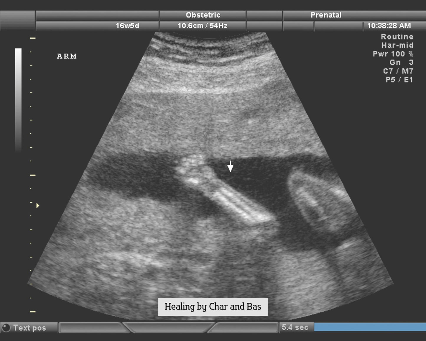 Baby scan
STRONG Fertility Spell & Healing
Fertility Spell
Fertility Healing
Distant healing
Same day healing
Baby spell
Reiki healing
Healing reiki
Future baby
Spirit baby
Healer
Energy healing
Boy
Girl