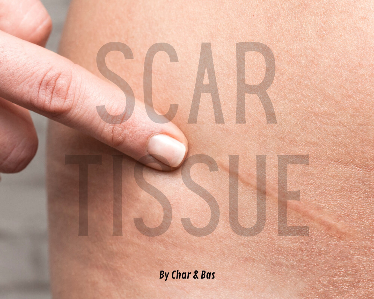 Scar Tissue Healing - Reiki Energy Healing for Surgical and Injury Scars - Holistic Approach